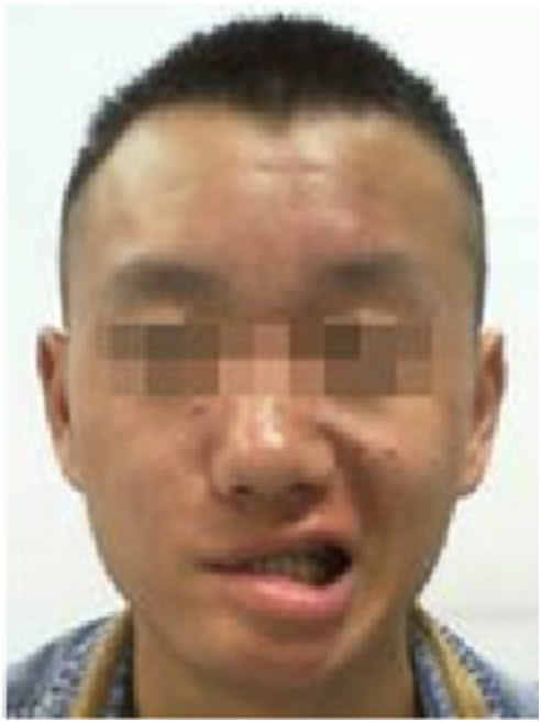 An unobtrusive computerized assessment framework for unilateral peripheral facial paralysis