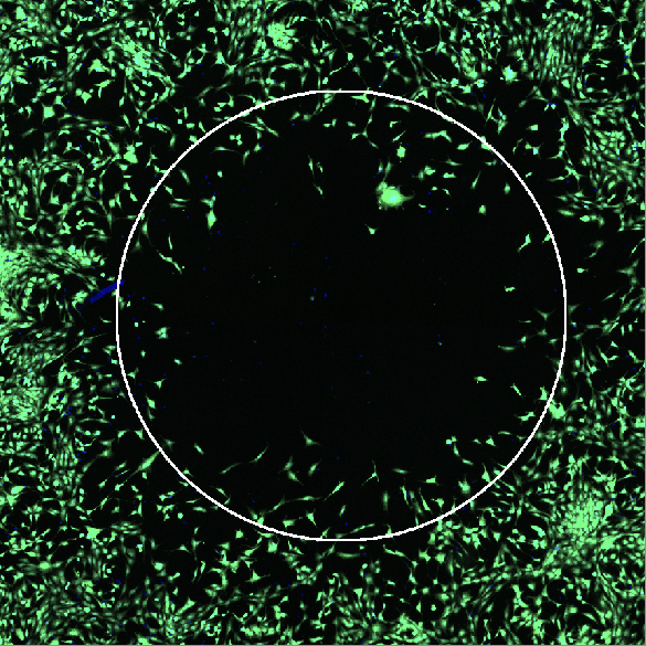 Automated Image Processing to Quantify Cell Migration